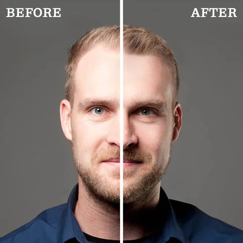 Vista 3 de Fibras voluminizadoras instantáneas para el cabello (1.06 onzas/suministro para 50 días, negro)