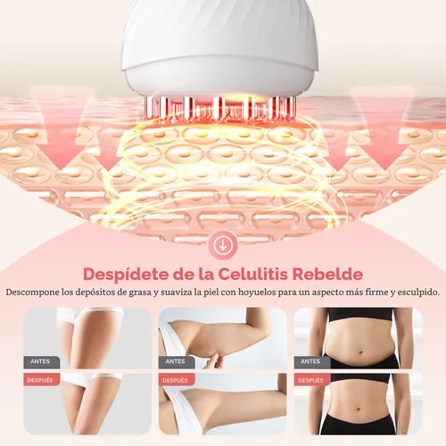 Vista 3 de Masajeador de drenaje linfático y herramienta de masaje anticelulitis, masajeador linfático, ayuda a reducir las estrías y la celulitis