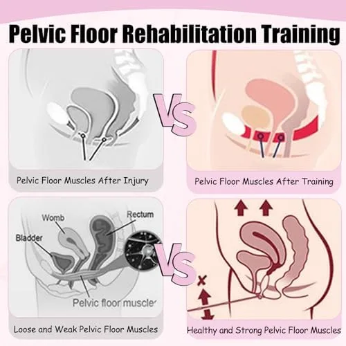 Vista 4 de Corrector muscular del suelo pélvico, silla Kegel para tratamiento de incontinencia femenina, ejercitador interno del muslo, fortalece la salud