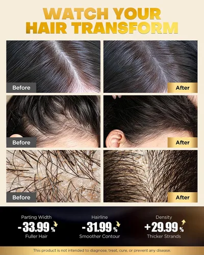 Vista 3 de Juego de champú y acondicionador de biotina para crecimiento del cabello con infusión de tripéptido, tratamiento hidratante voluminizador