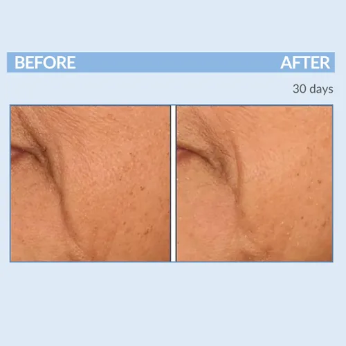 Vista 3 de Serious Skincare Vitamin A Force XR Retinol suero concentrado facial, micro exfoliante y rejuvenecimiento para piel radiante, para líneas, arrugas