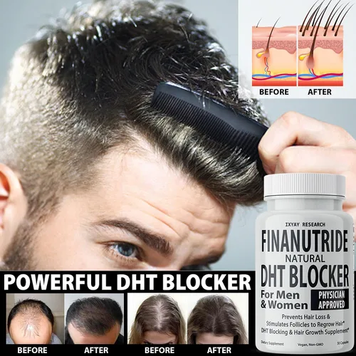 Vista 3 de Finanutride Natural DHT Blocker & Cápsulas de crecimiento del cabello para prevenir la pérdida de cabello, estimular los folículos capilares