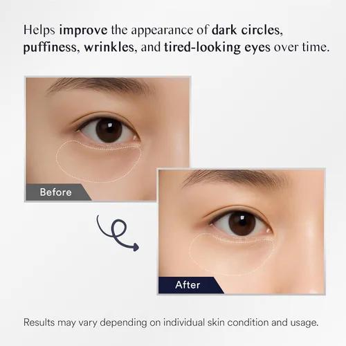 Vista 3 de Parches debajo de los ojos para ojos: 30 pares de mascarillas de gel para ojos hinchados y bolsas con colágeno de retinol - iluminador de ojos