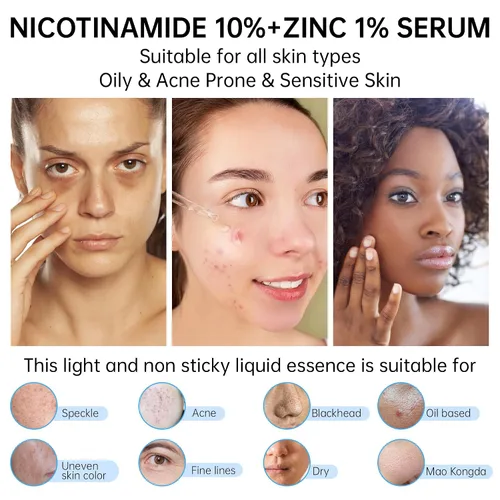 Vista 4 de Niacinamida 10%+Zinc 1% Suero Para La Cara, Suero De Niacinamida Para La Cara, Dermatólogo, Alivio De Enrojecimiento-1.0 fl oz 1floz