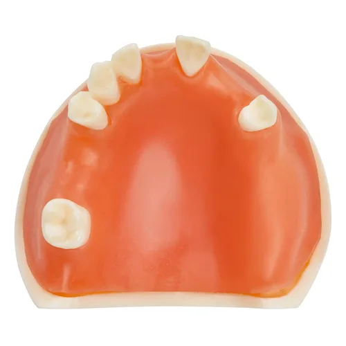 Vista 9 de Ultrassist Entrenamiento de implantes dentales Modelo edéntulo maxilar, maxilar simplificado con tejido suave, gran diente de entrenamiento