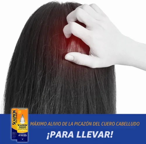 Vista 3 de Scalpicin Max Strength - Tratamiento de picazón en el cuero cabelludo, 1.5 onzas (paquete de 4)