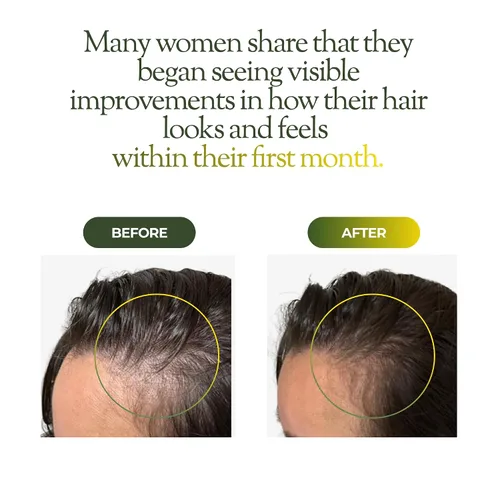 Vista 3 de regener8 Aceite para el cabello y el cuero cabelludo para mujeres, mezcla de aceites esenciales y portadores para adelgazamiento y pérdida