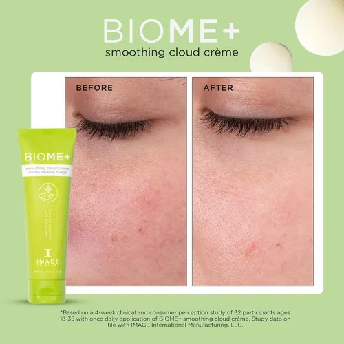 Vista 3 de IMAGE Skincare, BIOME+ Smoothing Cloud Crème, Microbiome Friendly Face Night Cream, Supports Skin Moisture Barrier