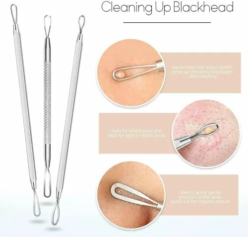 Vista 5 de Kit de herramientas para eliminar puntos negros, kit de 9 piezas, herramienta profesional de extracción de espinillas de acero inoxidable