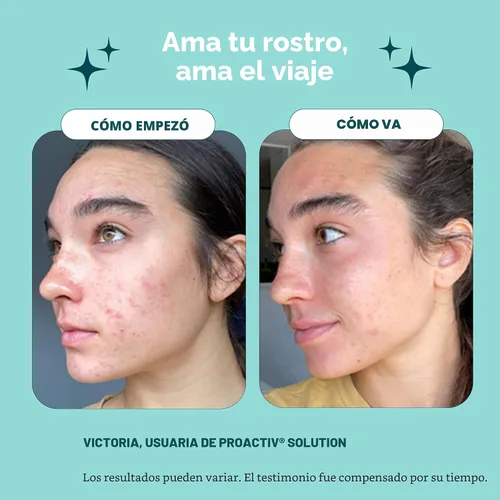 Vista 3 de Kit de principiante, sistema de tratamiento acné de 3 pasos PROACTIV (30 días)