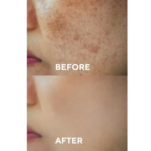 Vista 4 de The Ceel Suero corrector de manchas oscuras con glutatión y niacinamida – Suero facial iluminador para tono de piel desigual, hiperpigmentación