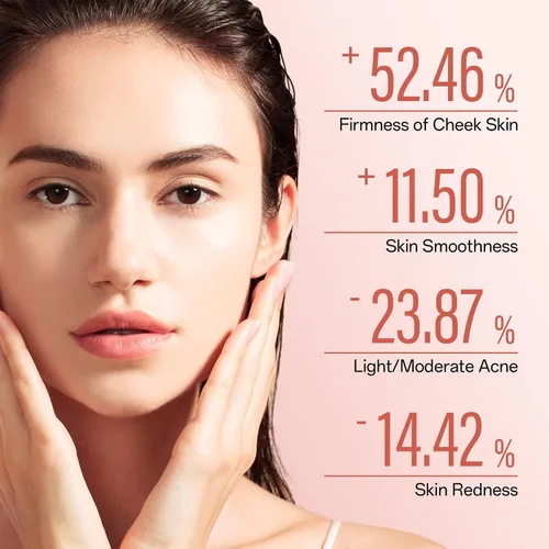 Vista 6 de Peach 70 - Suero de niacinamida, suero corrector de manchas oscuras para hidratación facial, suero facial para piel grasa, limpieza diaria