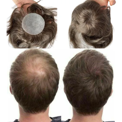 Vista 7 de Voloria Parche para el cabello calvo para hombres, 3.15 x 3.15 pulgadas, sistema de reemplazo de cobertura completa de piel de poliuretano