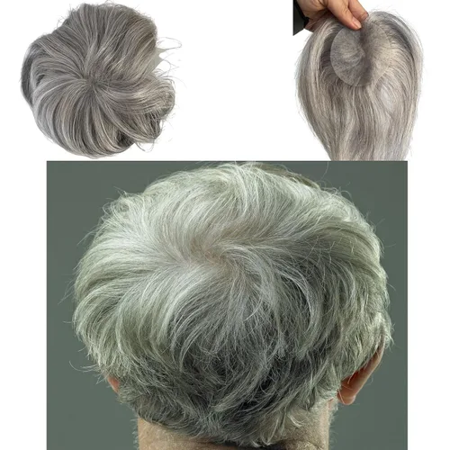 Vista 14 de Voloria Parche para el cabello calvo para hombres, 3.15 x 3.15 pulgadas, sistema de reemplazo de cobertura completa de piel de poliuretano