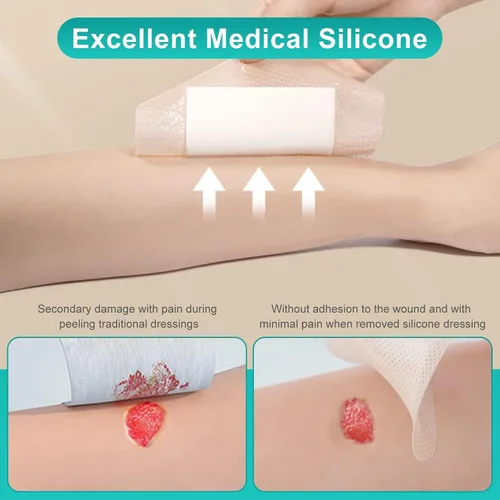 Vista 6 de Dimora Vendaje de espuma de silicona Silver Ag, vendaje estéril para heridas con borde adhesivo de silicona suave 4" x 4", apósitos impermeables