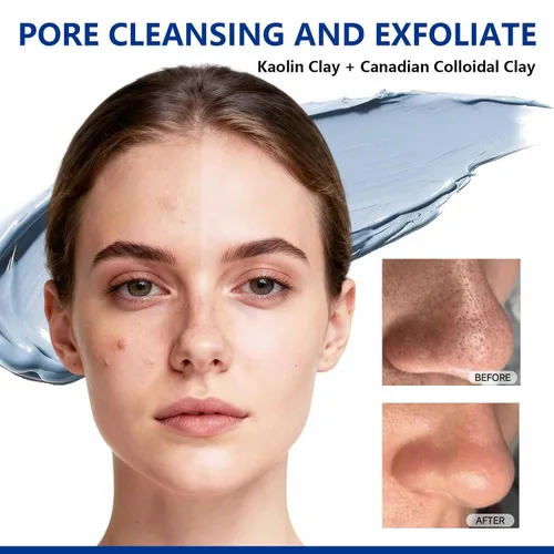Vista 2 de Máscara de arcilla azul limpiadora profunda de poros para cara, máscara facial de barro de puntos negros cero poros con niacinamida para igualar