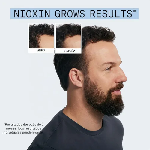 Vista 6 de Nioxin Kit de defensa de caída capilar Duo Sets Tratamiento capilar sin El poder de dos: champú para la caída del cabello y tratamiento intensivo