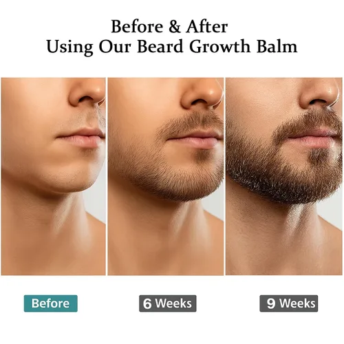 Vista 4 de Estimulante para Barba – Bálsamo de Crecimiento Ultra Potente, Bálsamo Estimulante para Barba, Hidrata y Fortalece la Barba, 100 ml / 3.5 oz