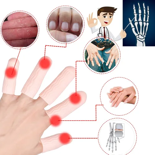 Vista 2 de Pnrskter Cunas de gel para dedos, soporte protector de dedos (14 piezas, transpirables) Mangas para dedos ideales para dedos en gatillo, eczema