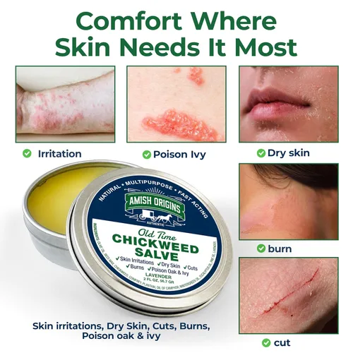 Vista 7 de Amish Origins Old Time Chickweed Salve 2 oz - El mejor bloqueador de hiedra venenosa/roble venenoso, bálsamo curativo para trastornos de la piel
