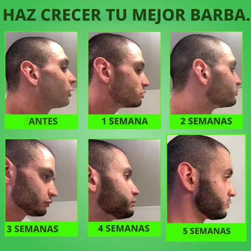 Vista 4 de Minoxidil para el crecimiento de la barba: suero al 5% con 2 veces biotina y agua de arroz, promueve el cabello facial más grueso y lleno, ideal