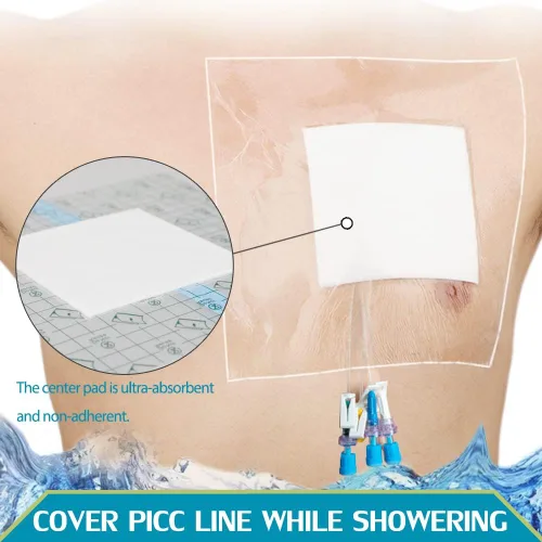 Vista 2 de 25 piezas impermeables para catéter de diálisis PD para heridas, vendajes de vestidor de isla para ducharse, línea de pícnic, pecho, peritoneal