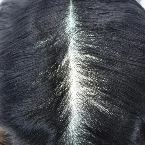 Vista 3 de Tupé de pelo para hombres, sistema de reemplazo invisible ultra fino de piel para hombre, protesis capilar para hombre, 8 x 10 pulgadas, #1 negro