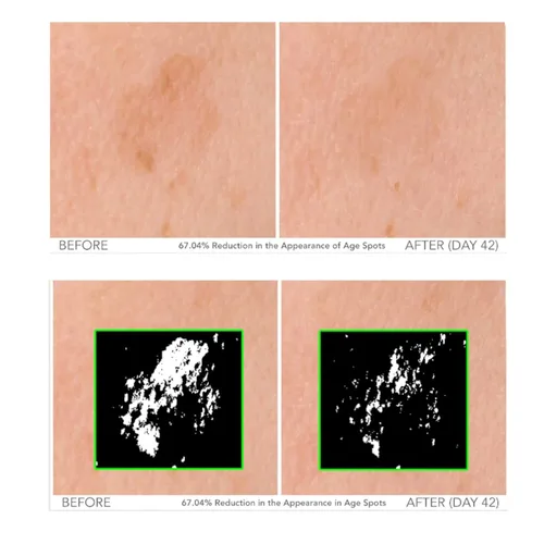 Vista 2 de Serious Skincare - Beyond - Suero intensivo de vitamina C para la cara - Tratamiento facial de 60 días para una piel sana y brillante e iluminadora