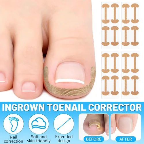 Vista 7 de SelfTek Kit de uñas encarnadas – Kit profesional de corrector de uñas encarnadas con tiras transpirables y parches curvos, lima sin dolor