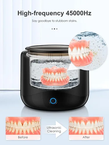 Vista 2 de Limpiador ultrasónico de retenedores, máquina limpiadora de retenedores de 45 kHz para dentaduras, protectores bucales, alineadores, frenos