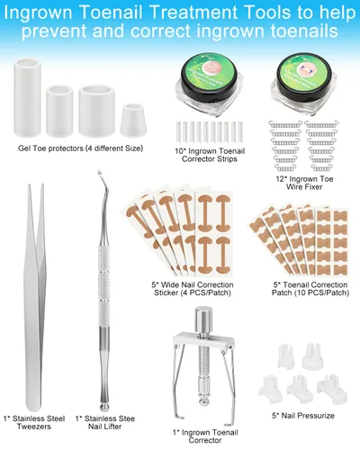 Vista 2 de Kit de eliminación de uñas encarnadas, tratamiento de uñas encarnadas, herramientas correctoras de uñas encarnadas vienen con soportes para uñas
