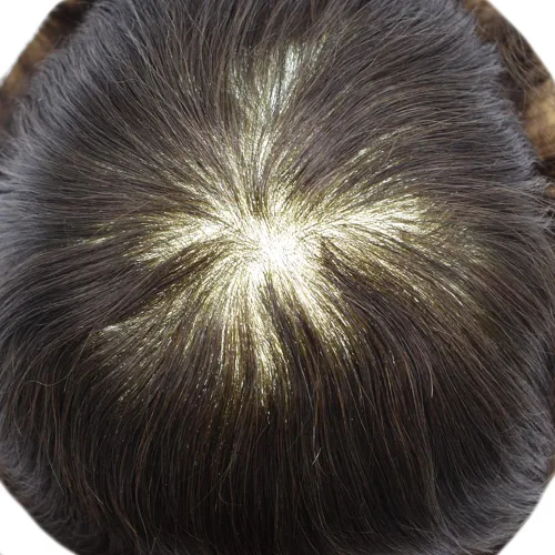 Vista 5 de Toupee - Pieza de cabello humano real, sistema de reemplazo de cabello de piel ultrafina, piezas de cabello tipo tupé, prótesis de cabello con bucle