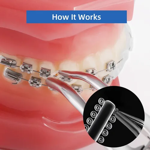 Vista 5 de Annhua Lazos dentales de ligadura de ortodoncia 1040 piezas, bandas de color Ortho Braces Ligadura Lazos elastoméricos O-Rings - Transparente