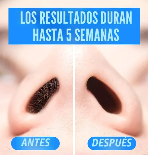 Vista 4 de KENASHII Kit de cera nasal 100 g de cera, 24 aplicadores Kit de depilación para hombres y mujeres Incluye toallitas bálsamo y protectores