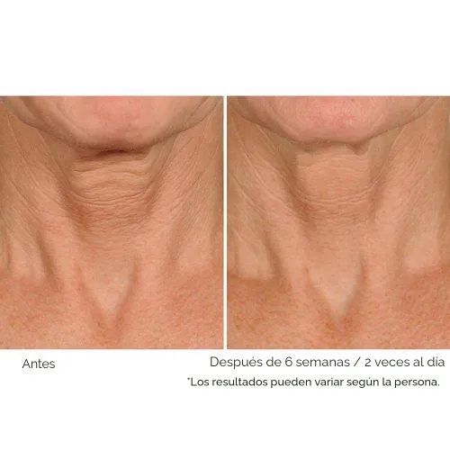 Vista 4 de NassifMD Deco-Lift Neck & Decollete Firming & Lifting Complex