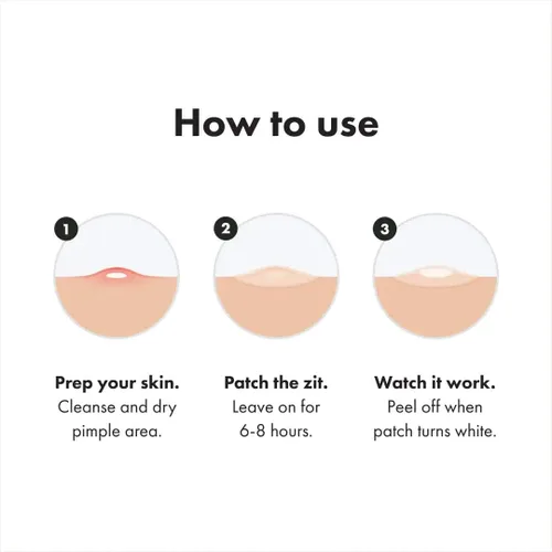 Vista 4 de Mighty Patch™ Paquete variado de Hero Cosmetics – Parches hidrocoloides para espinillas para el acné para cubrir zits e imperfecciones, calcomanías