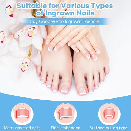 Vista 5 de Kit de eliminación de uñas encarnadas con tiras de uñas encarnadas, parche corrector de uñas curvas, lima de uñas y herramientas de pedicura