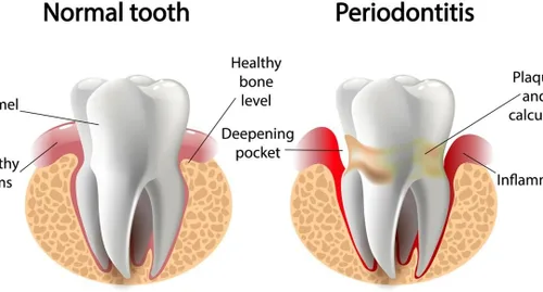 Vista 8 de Pasta de dientes Anti Periodontal Formula con maris sal - fuente natural de minerales y microelementos (3.5 oz, 3.4 fl oz)