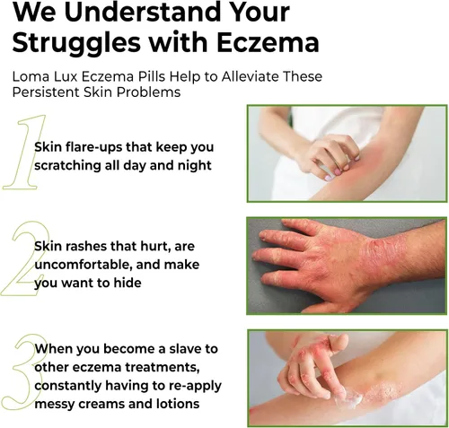 Vista 4 de Loma Lux Píldoras para el eccema – Remedio natural para el alivio del tratamiento del eccema – Desarrollado por dermatólogos – 7 minerales que