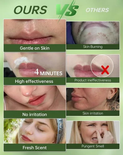 Vista 4 de Crema de depilación facial sin dolor para mujeres - Kit 2 en 1 con crema calmante para piel sensible Removedor de vello de labio superior