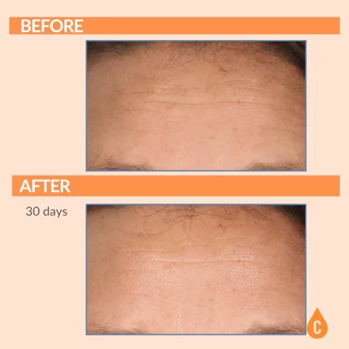 Vista 5 de Serious Skincare Suero de vitamina C para cara, suero facial antienvejecimiento con colágeno, vitamina E, cuidado hidratante de la piel
