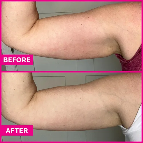 Vista 4 de Arm Sleek Arm - Crema reafirmante para el brazo, tratamiento de piel crepey y loción tensora corporal para reducir la apariencia de piel suelta