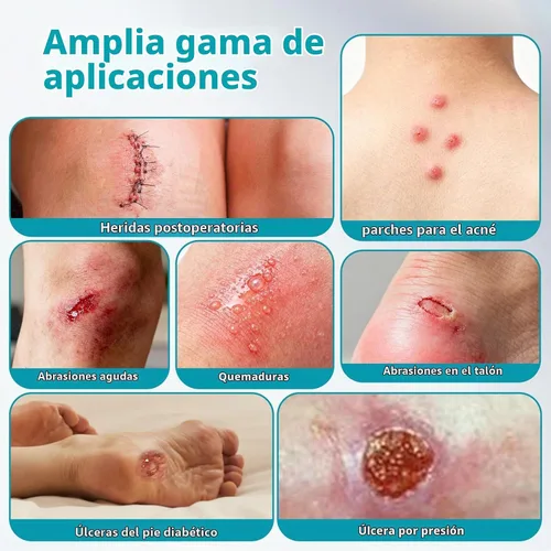 Vista 7 de Dimora Rollo de vendaje hidrocoloide de grado médico (2 pulgadas x 16 pies), apósitos hidrocoloides altamente absorbentes para el cuidado