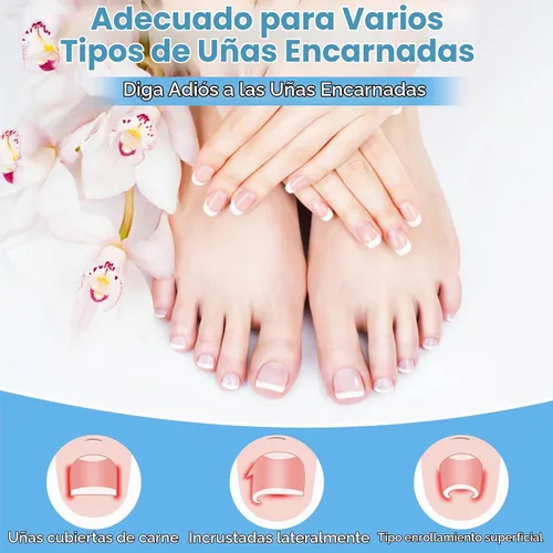 Vista 5 de Kit de eliminación de uñas encarnadas con tiras de uñas encarnadas, parche corrector de uñas curvas, lima de uñas y herramientas de pedicura
