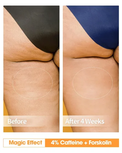 Vista 3 de Crema anticelulítica para glúteos y muslos, crema reafirmante corporal con 4% de cafeína y forskolina, crema reafirmante B Flat Belly y crema