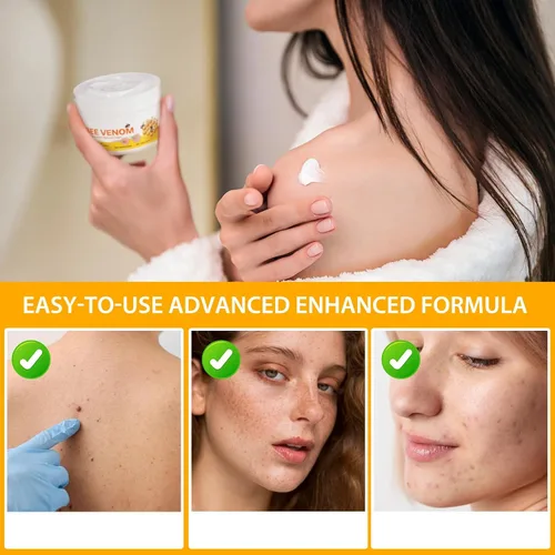 Vista 4 de ITSDAWN Bee Venom Cream, crema para la piel de veneno de abeja, crema hidratante hidratante para cara y todas las partes del cuerpo, 3.52 oz