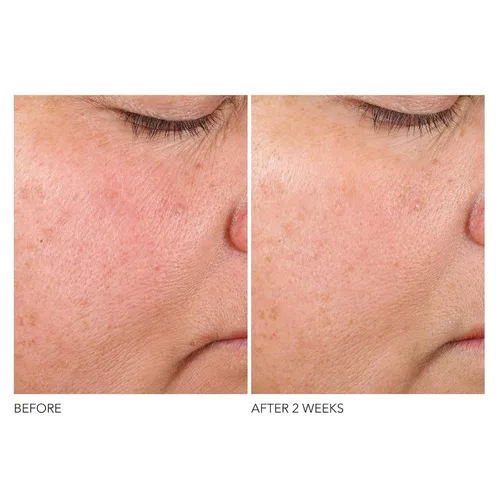 Vista 5 de Dr. Dennis Gross Advanced Retinol + Ferulic Texture Renewal Serum - Fórmula antienvejecimiento para suavizar la textura, aumentar el brillo