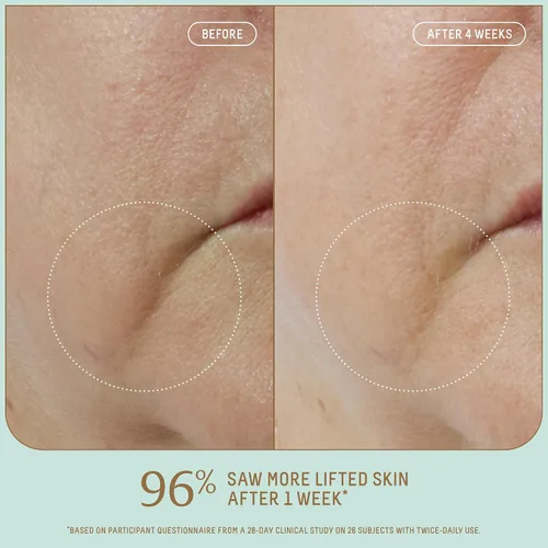 Vista 2 de Biossance Squalane + Firm & Lift Dual Serum - Suero facial para piel madura - Levanta e hidrata - Reduce las arrugas - Ácido hialurónico, escualano