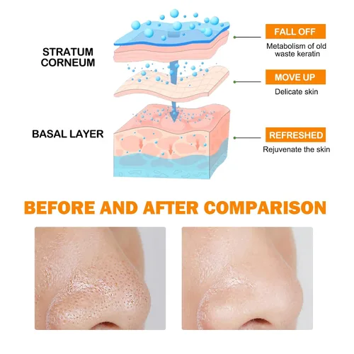 Vista 6 de Orange Enzymes - Gel exfoliante facial de proteasa y niacinamida, gel limpiador exfoliante suave para limpieza profunda de poros y piel suave