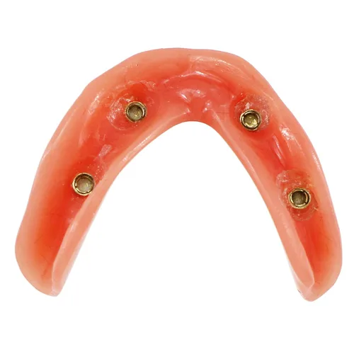 Vista 7 de Demostración inferior inferior inferior de la restauración del modelo M6003 Typodont Sobredentadura 4 implantes inferior inferior de los dientes